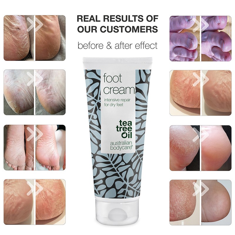 Australian Bodycare Foot Cream 100 ml