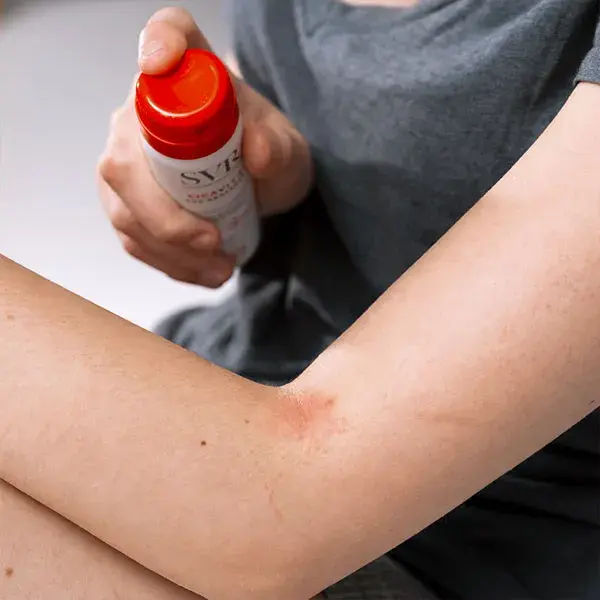 SVR CICAVIT+ SOS RISCOS Anti-irritação Anti-riscos Anti-marcas 40ml