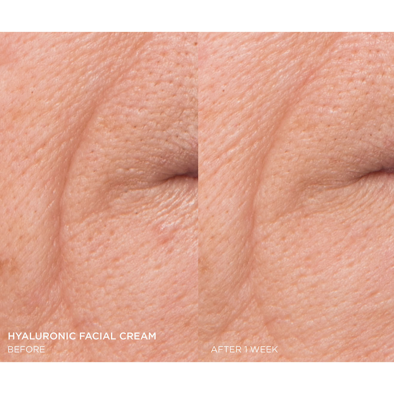 Dr. Brandt Crème visage à l'acide hyalluronique - 50 ml