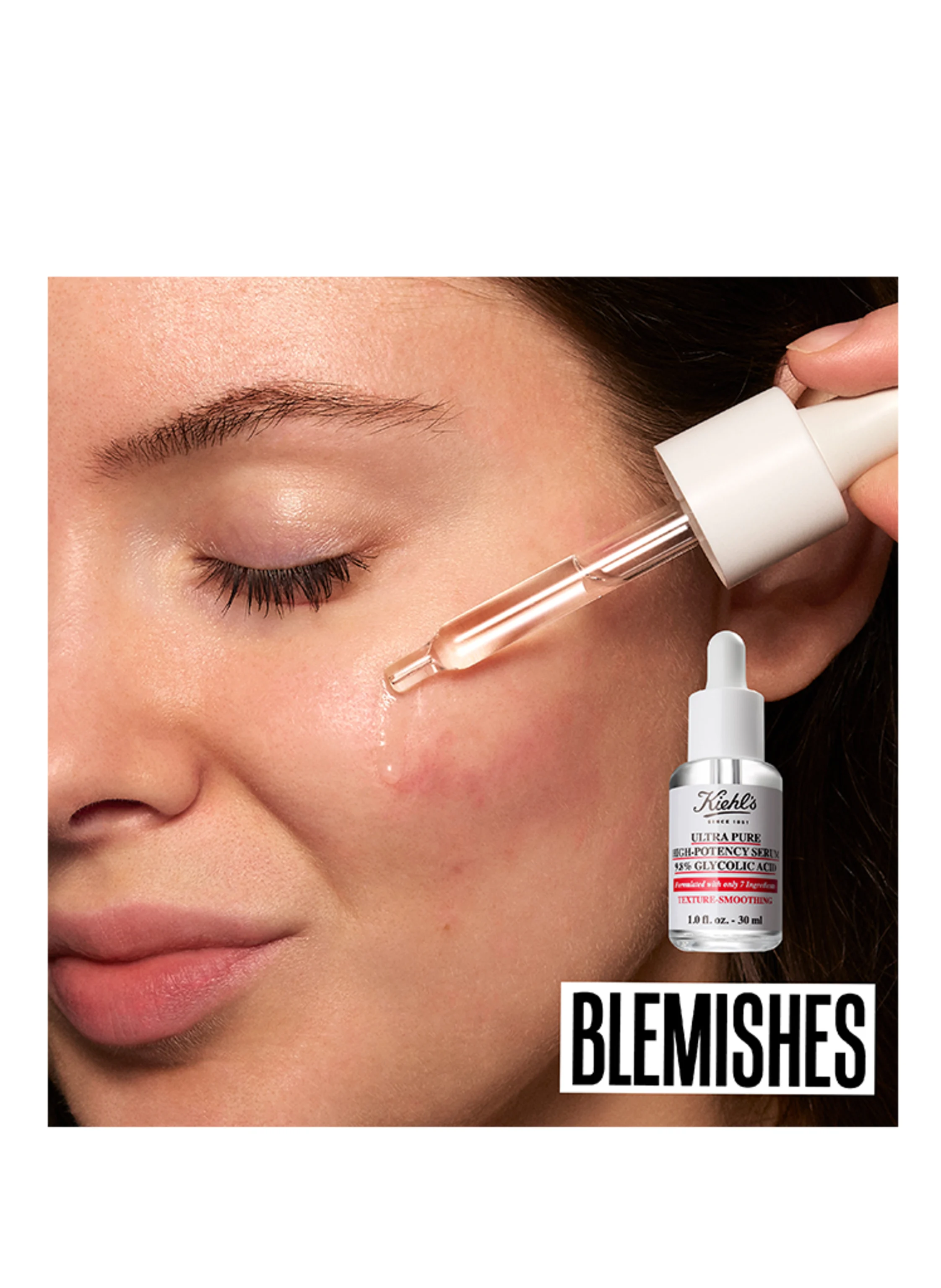 Kiehl's ULTRA PURE HIGH-POTENCY SERUM 9.8% GLYCOLIC ACID