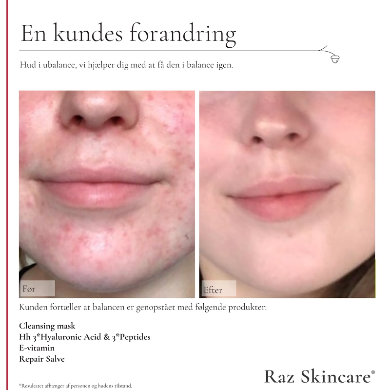 Raz Skincare Cleansing Mask 200 gr.