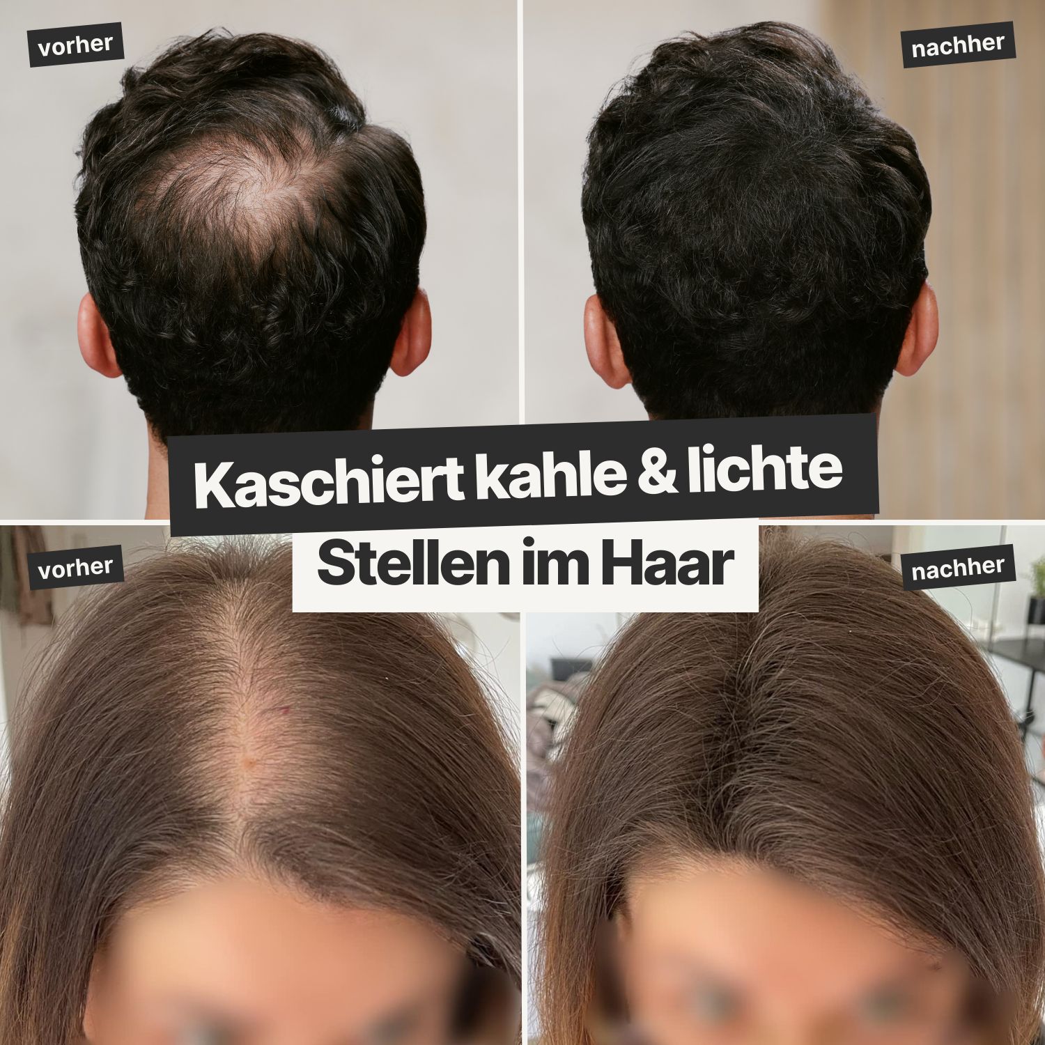 IMPERIO® Streuhaar zur Haarverdichtung - 100% Baumwolle, dermatologisch getestet