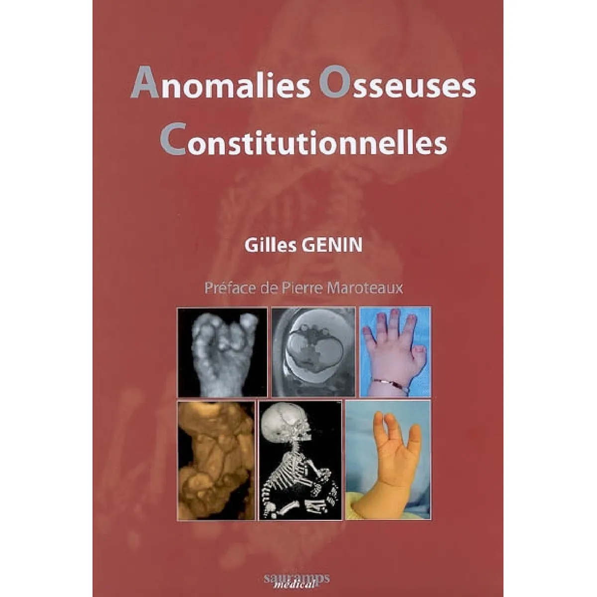 Anomalies osseuses constitutionnelles : démarche puridisciplinaire : obstétrique, pédiatrique, génétique, radiologique, chirurgicale et psychologique · Occasion