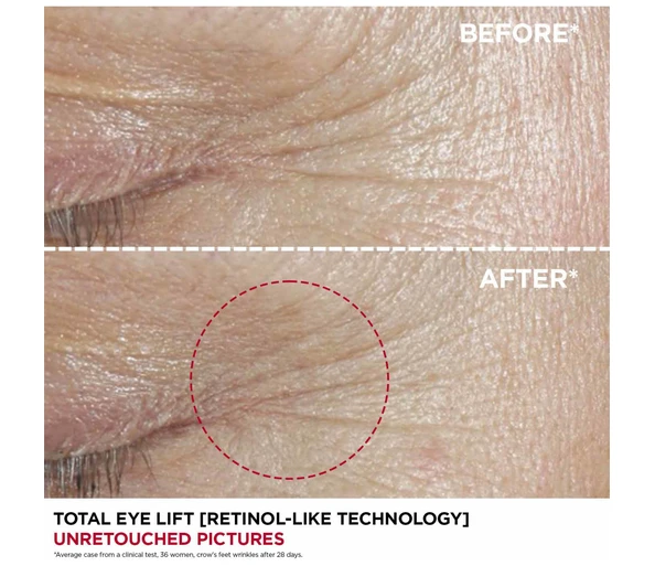 Clarins Total Eye Lift Augencreme