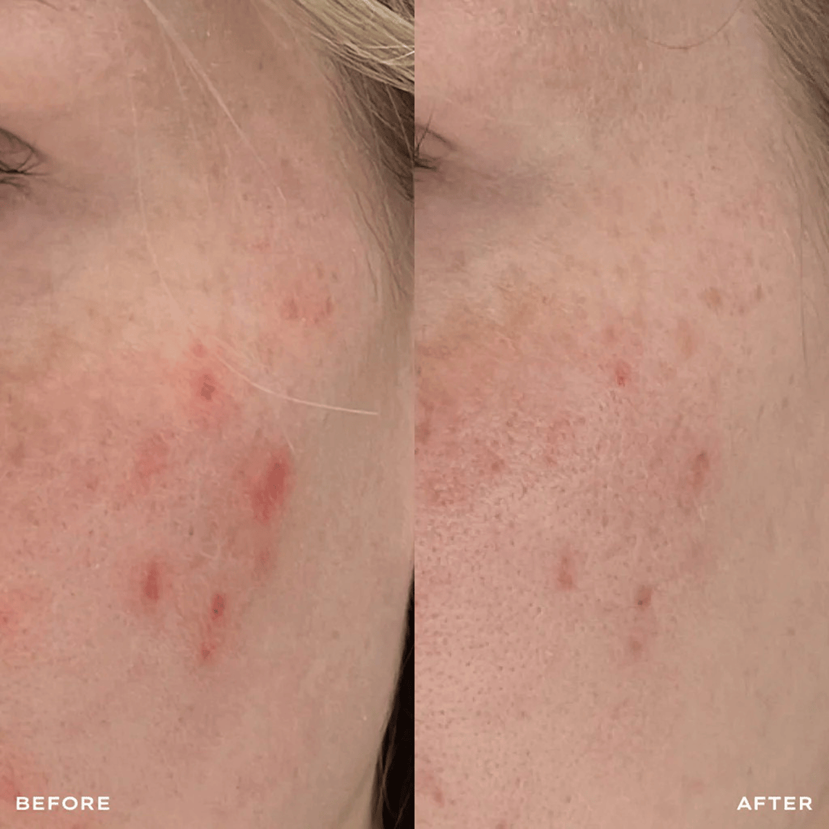 The Spot Solution 30ml