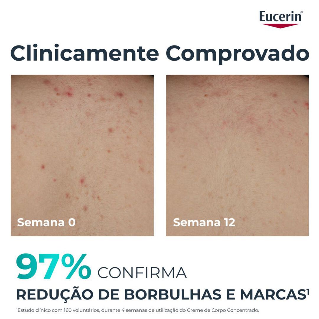 EUCERIN  DermoPure Creme de Corpo Concentrado - 200ml