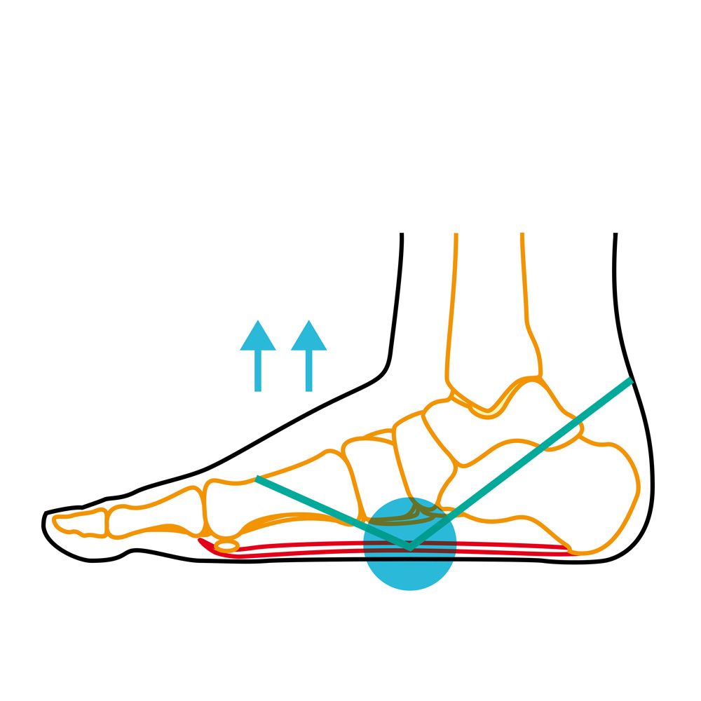 Compressana TAPE SOX Knick-Senkfuß Pronation Control