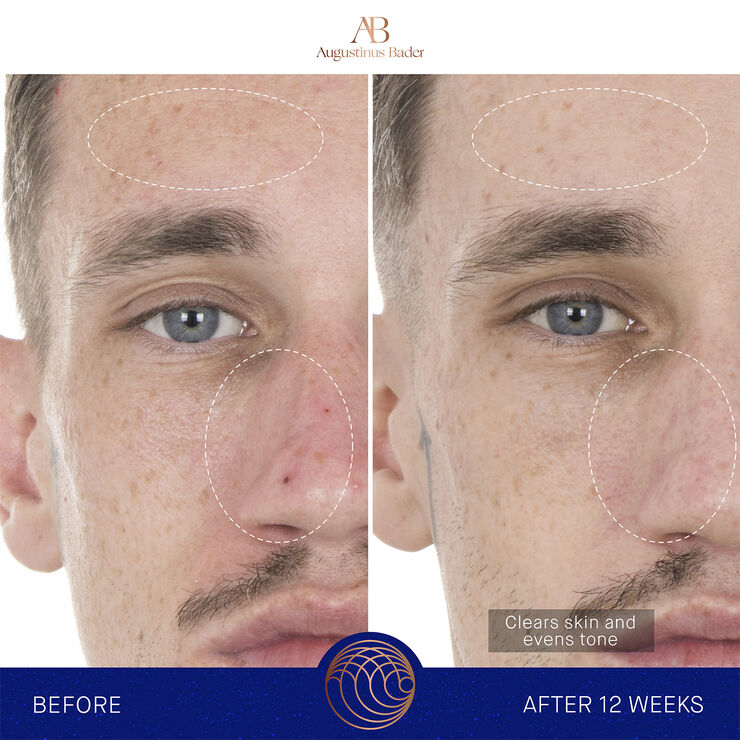 Augustinus Bader The Retinol Serum
