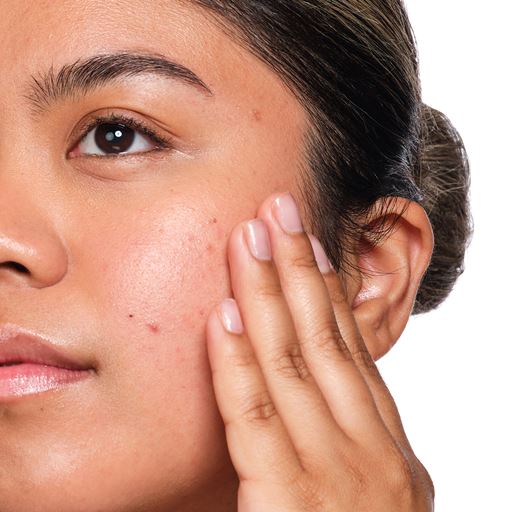 The Ordinary Salicylic Acid 2% Solution Serum, 30 ml