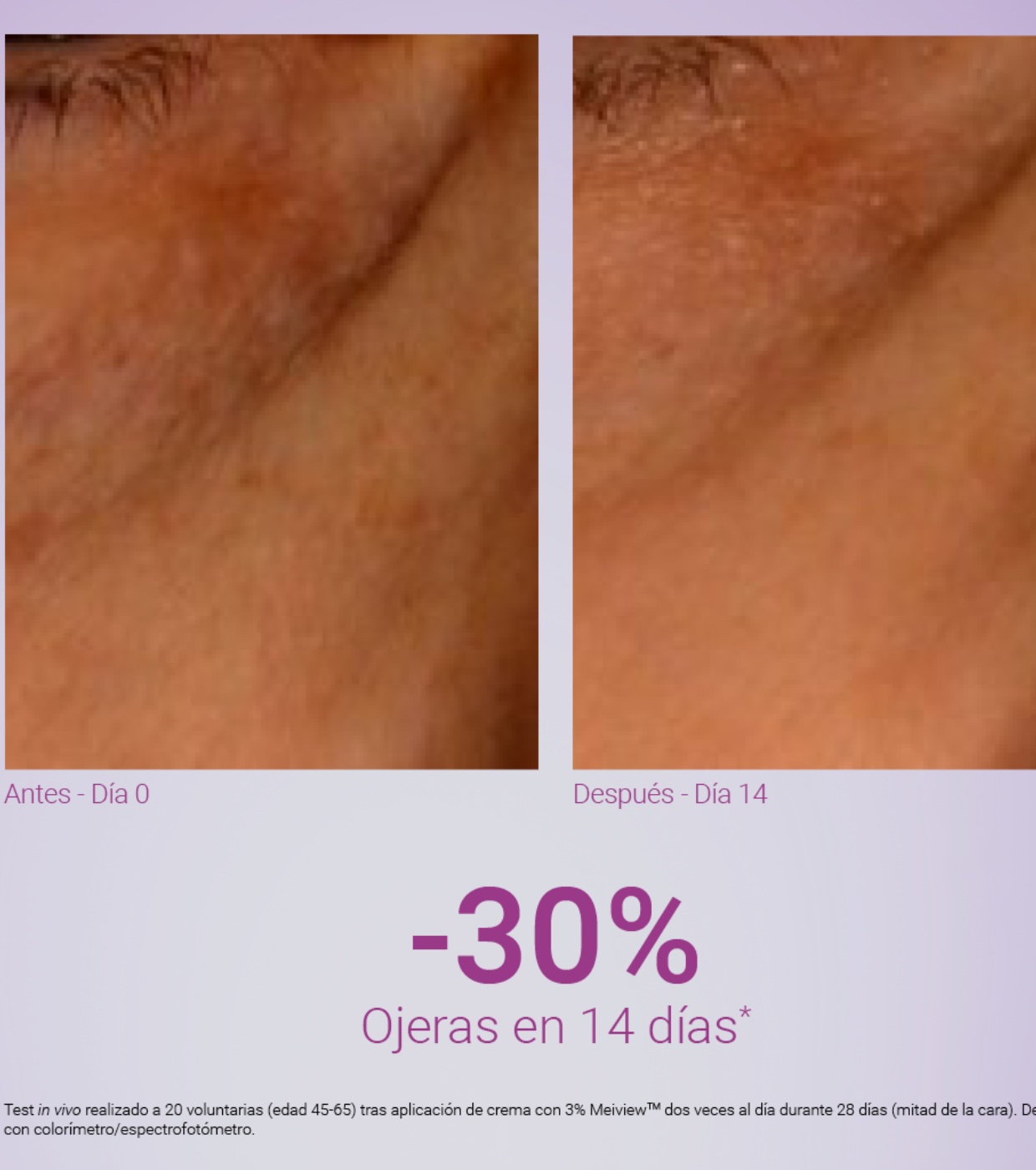 Primaderm - Contorno de olhos antirrugas Xpert Expression Contour