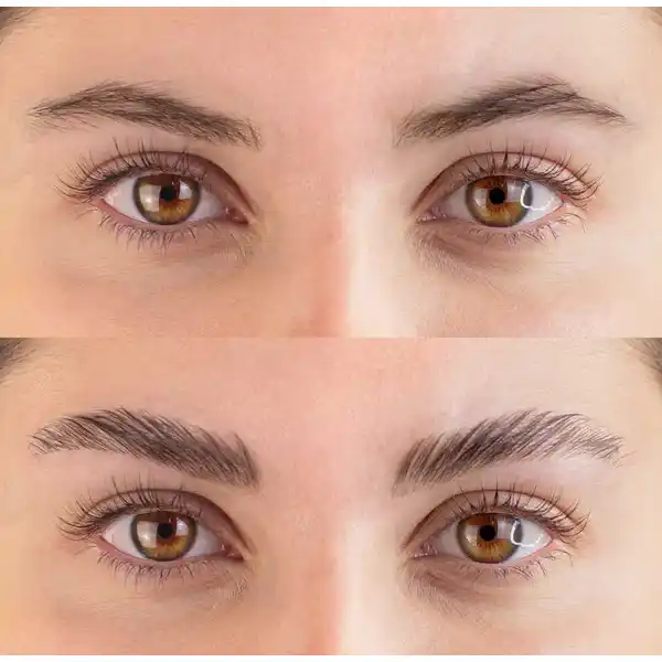 Browlift Kit - Mini