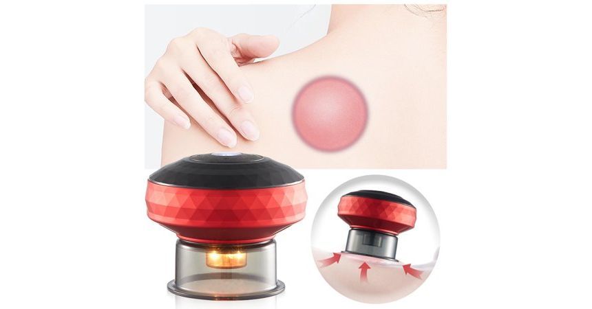 HOMTEC - Oplaadbare cuppingtherapie-massager
