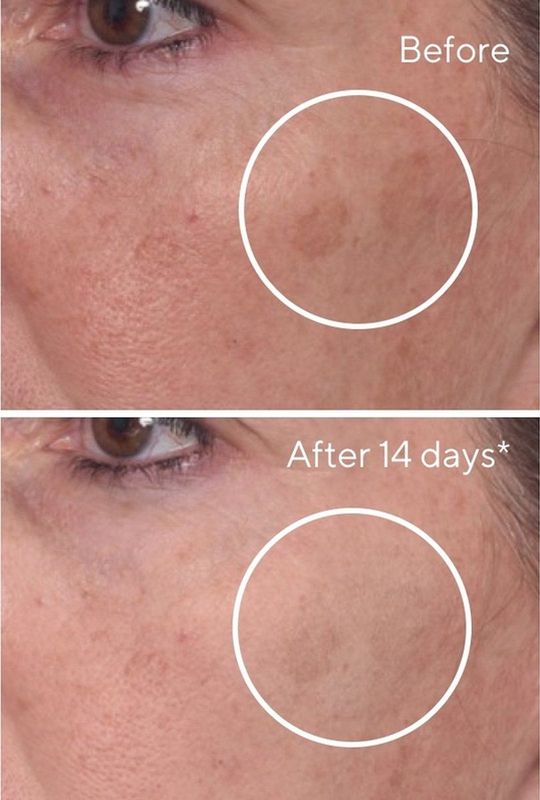 Murad - Rapid Dark Spot Correcting Serum - 30 ml