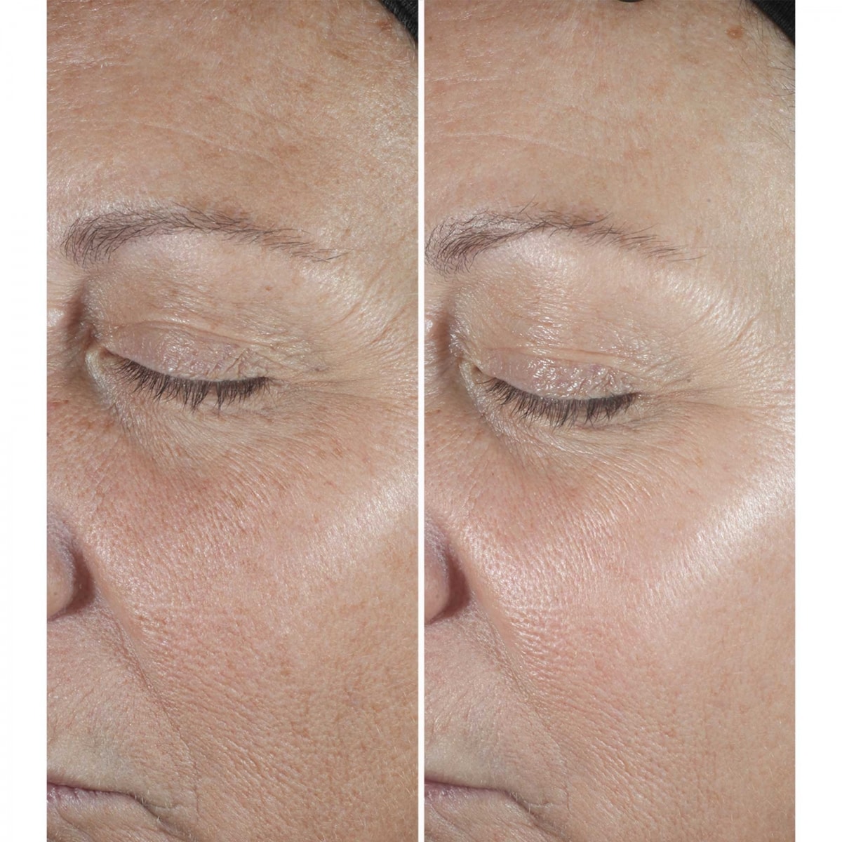 CLINIQUE Smart Clinical Repair CLINIQUE Smart Clinical Repair Sérum Correcteur Anti-Rides