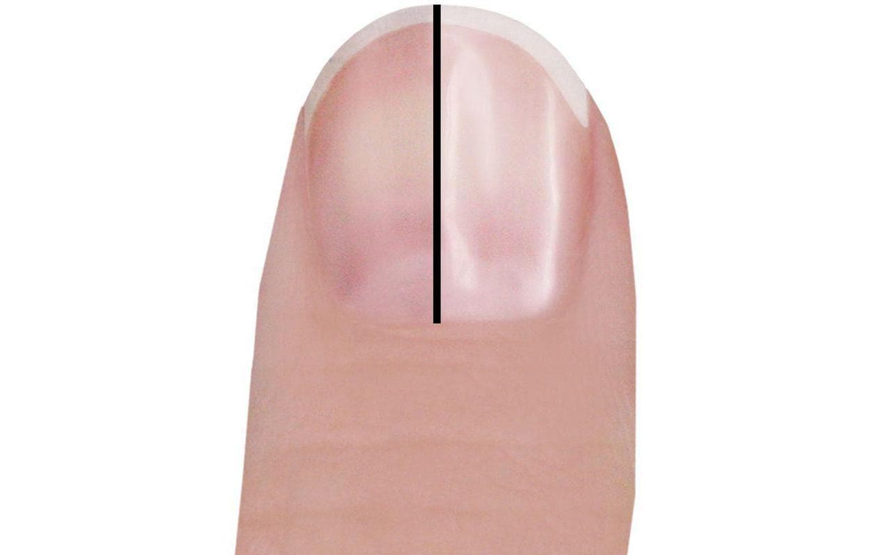 Perfect Nails ErsatzrollenErsatzrollen für Trisa Perfect Nails