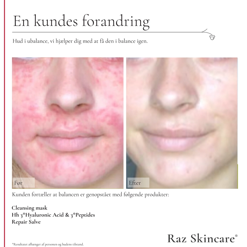 Raz Skincare Hh 3 x Hyaluronic Acid & 3 x Peptides 30 ml