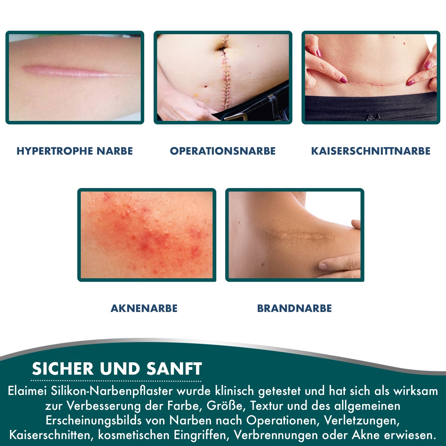 P-Beauty Wundpflaster für Narben