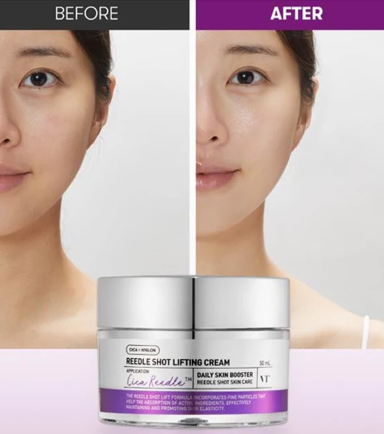 VT Cosmetics - Creme antienvelhecimento com lifting Reedle Shot