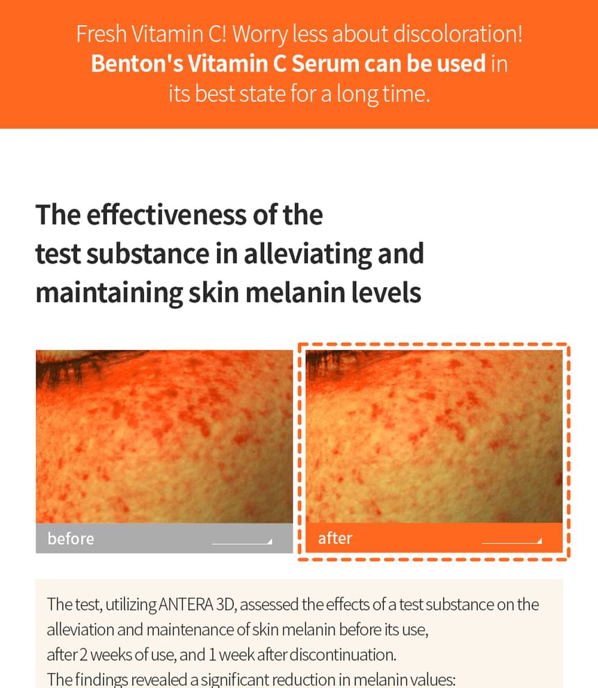 Benton - Vitamine C-serum