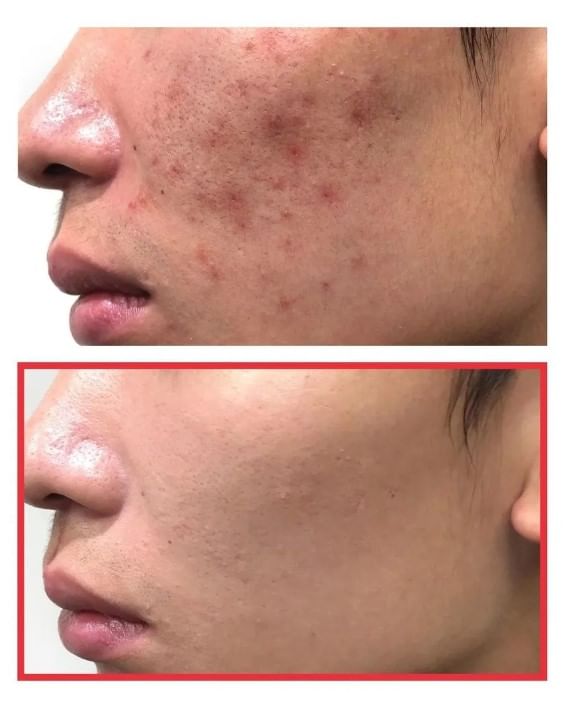 SOME BY MI - Snail Truecica Miracle Repair Toner