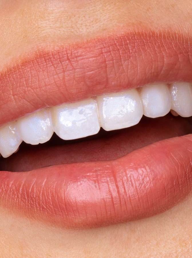 Hismile Glostik Tooth Gloss 4ml