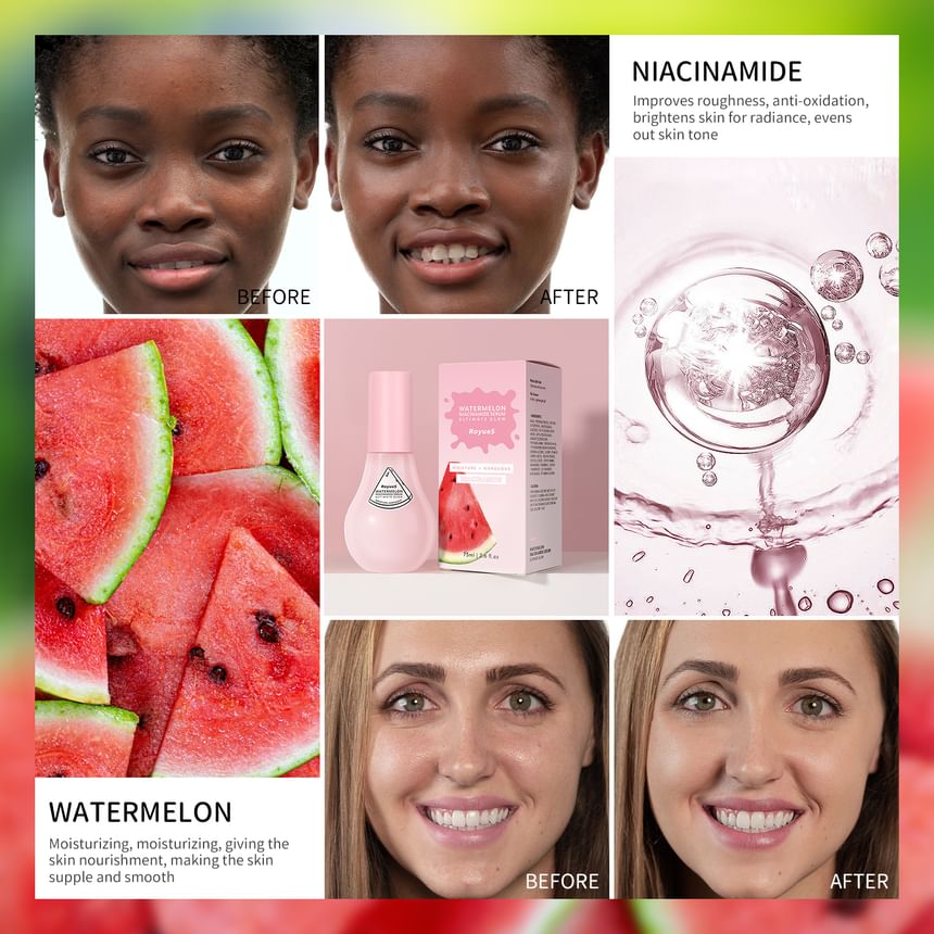 RoyueS - Watermeloen Niacinamide Serum