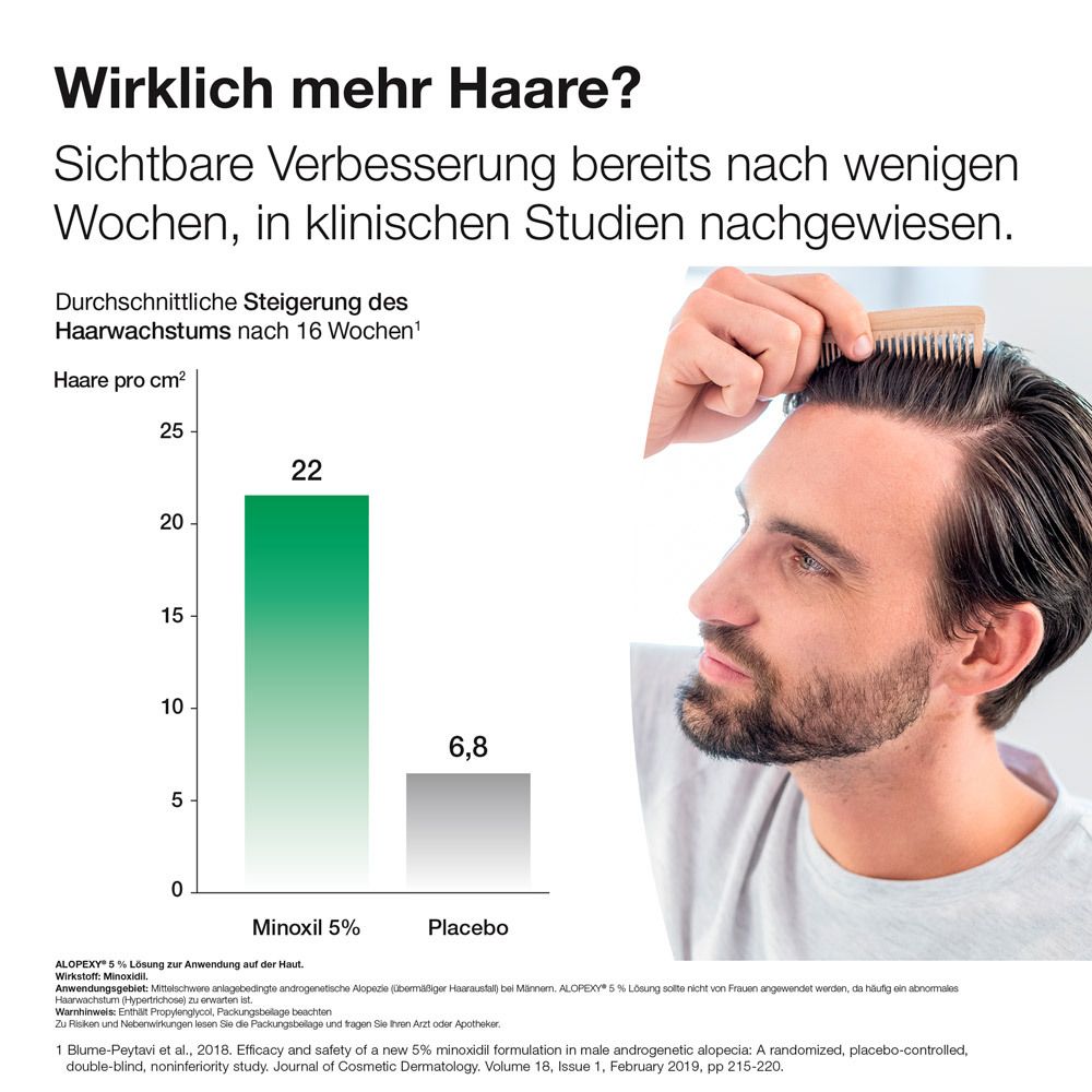 ALOPEXY 5% Lösung zur Anwendung auf der Haut 3X60 ml gegen anlagebedingten Haarausfall