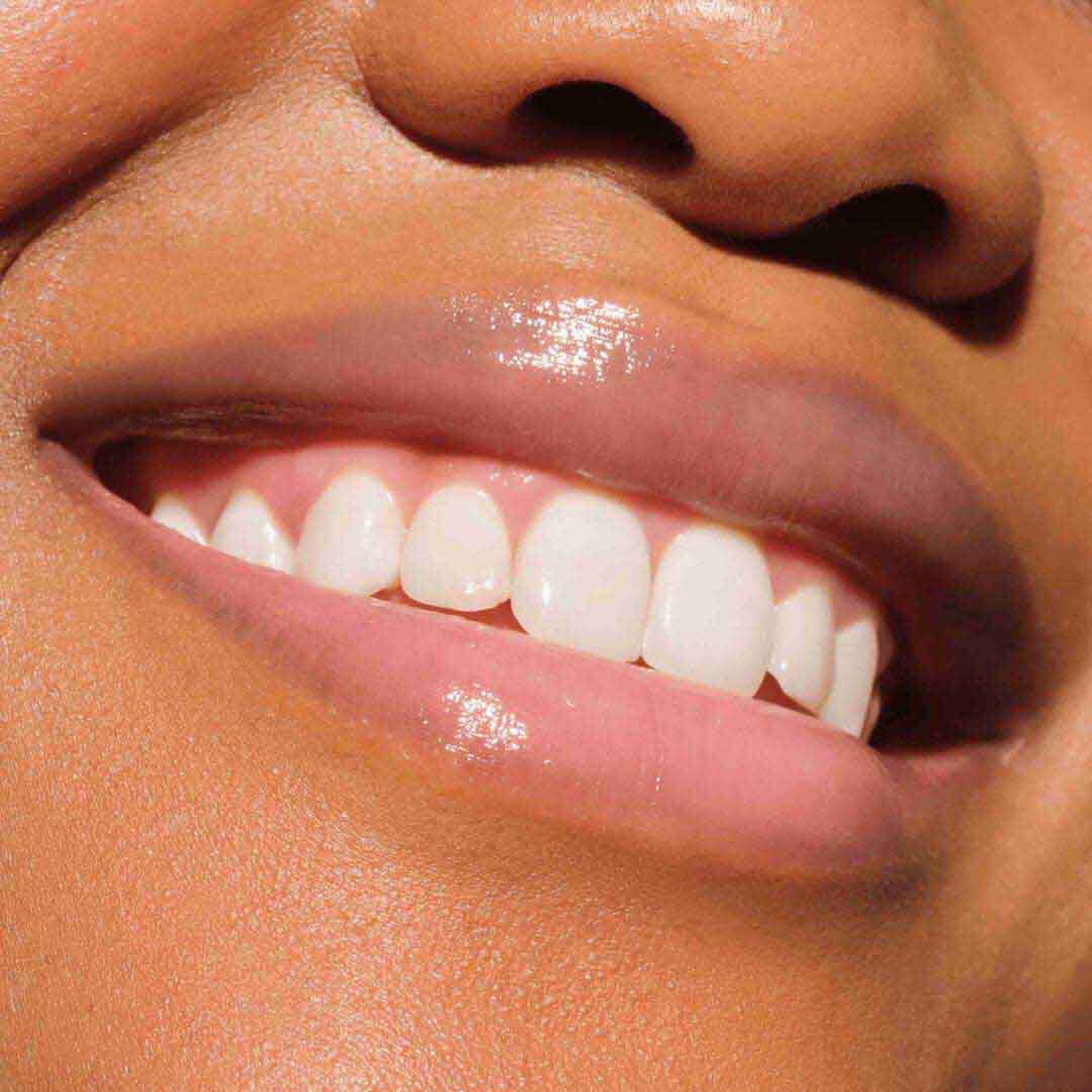 CATRICE  Lip Plumper - Preenchimento para lábios de fusão e preenchimento