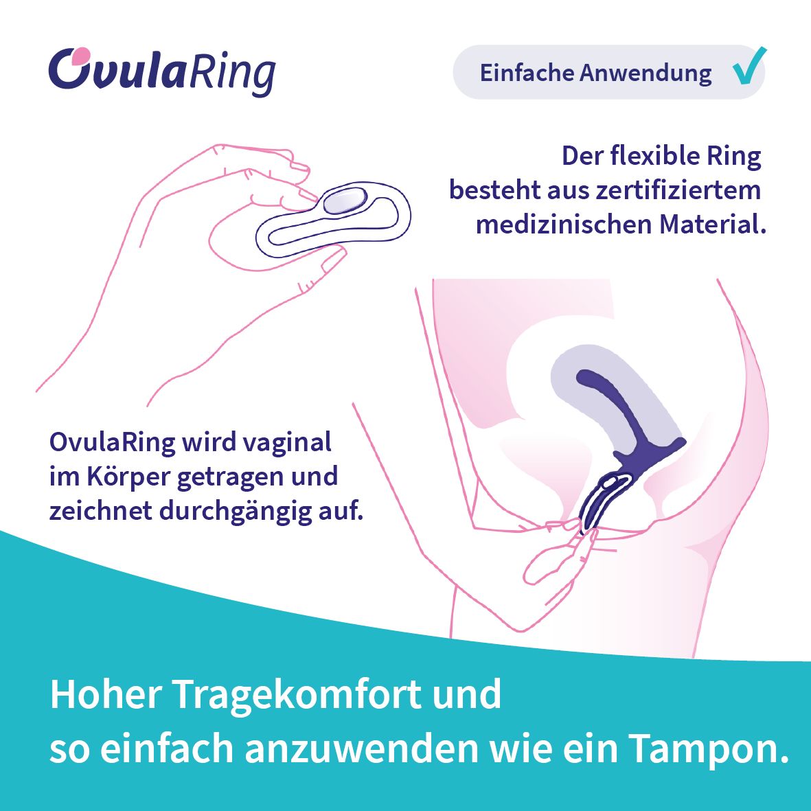 OvulaRing Zyklustracker - zyklusbasiertes Training für iOS (6 Monate inkl. App)