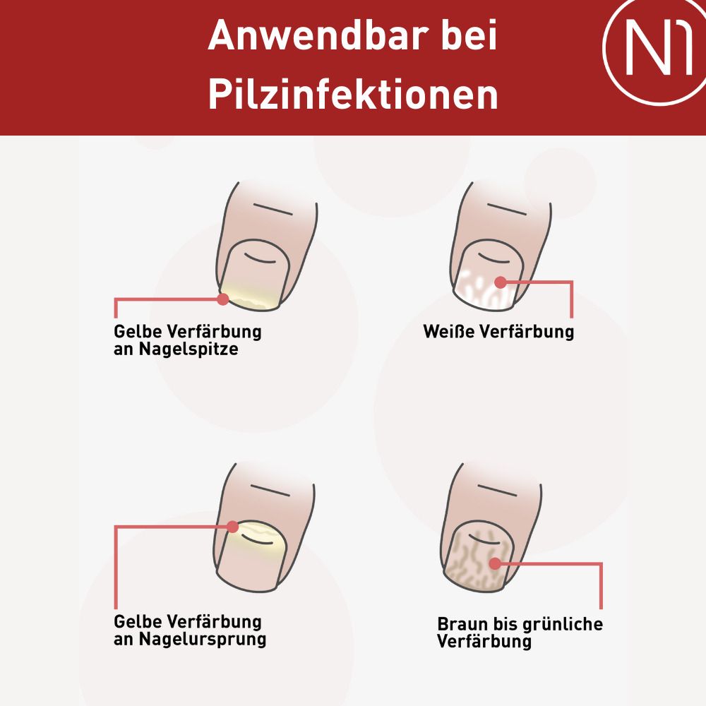 N1 Nagelpilz Lösung patentierte Monatskur