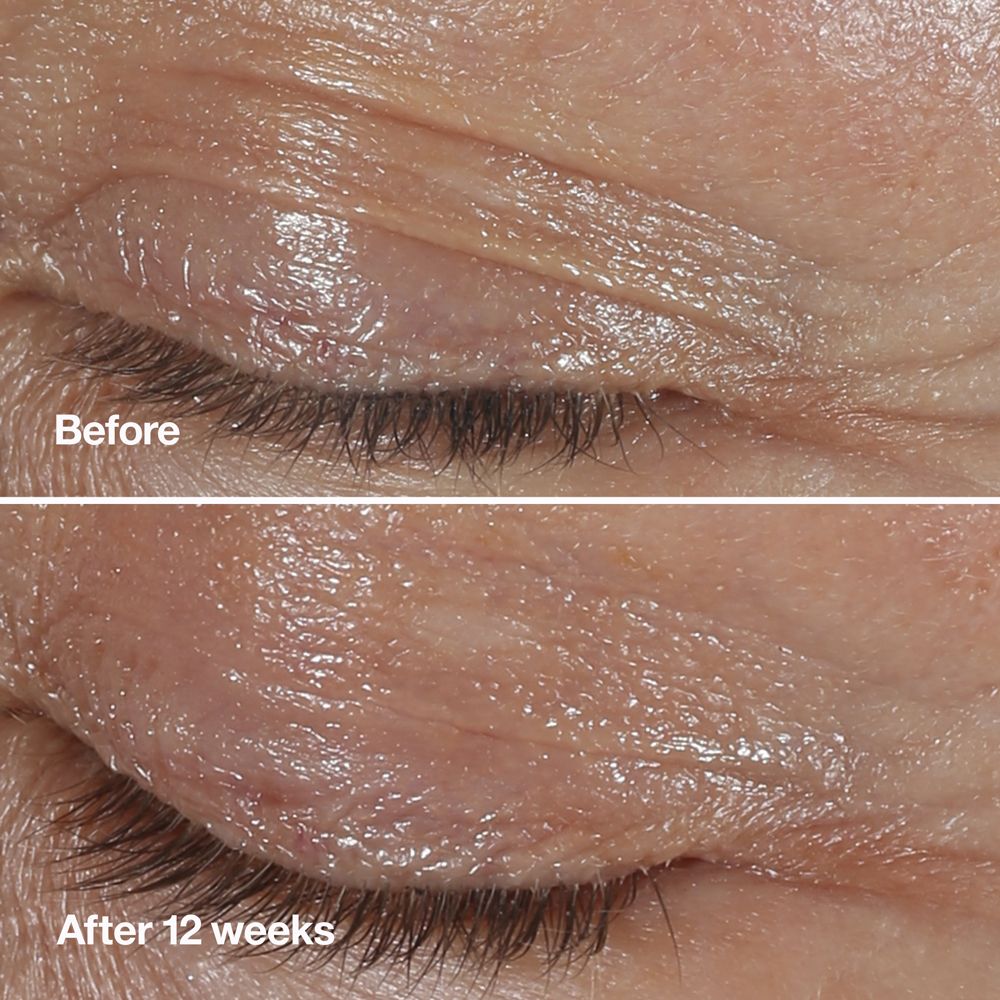 CLINQUE Smart Clinical Repair™ Wrinkle Correcting Eye Cream Anti-Age Augencreme