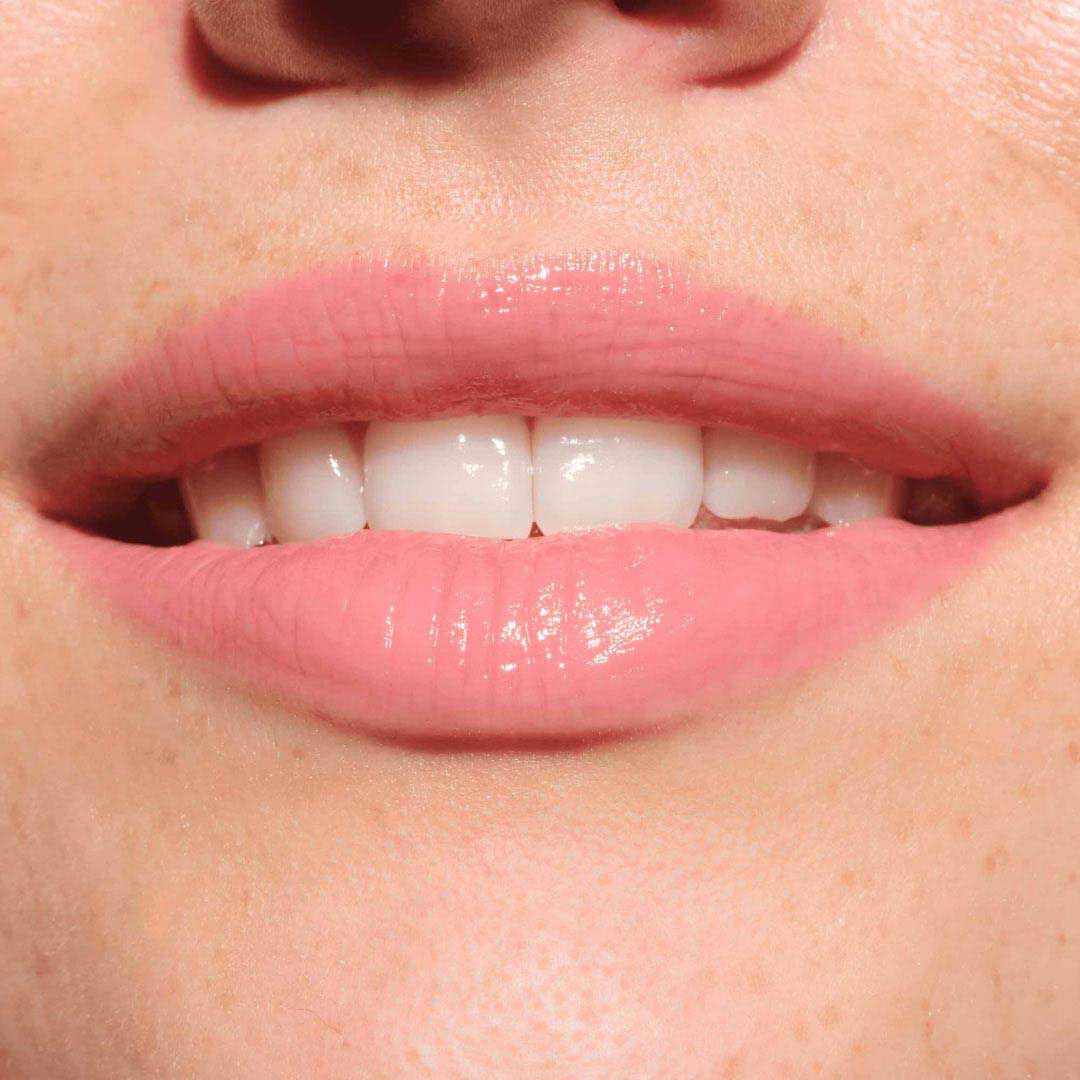 CATRICE  Lip Plumper - Preenchimento para lábios de fusão e preenchimento