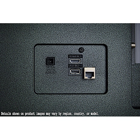 LG 75