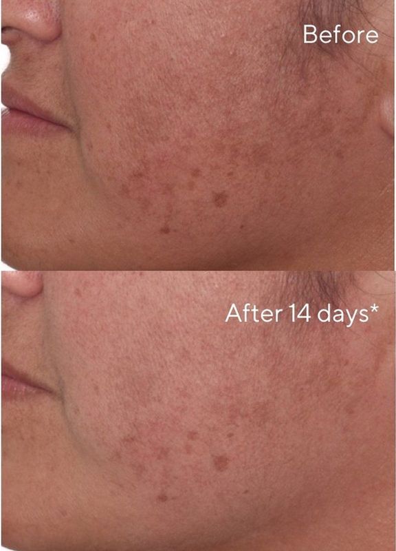 Murad - Rapid Dark Spot Correcting Serum - 30 ml