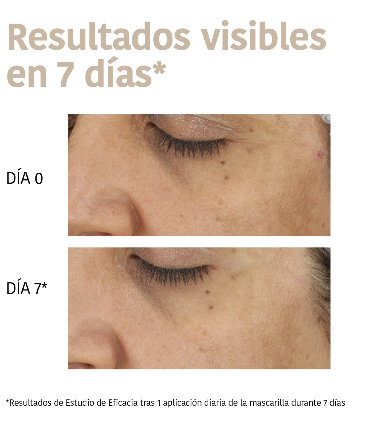 Iroha Nature - Máscara facial de ácido tranexâmico Dark Spots