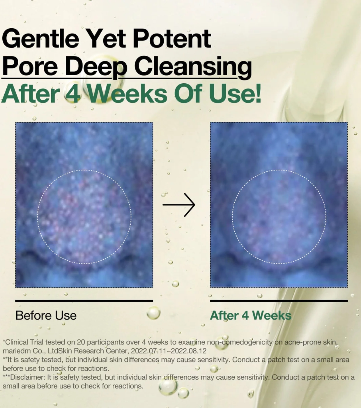 Anua - Óleo de Limpeza Heartleaf Pore Control