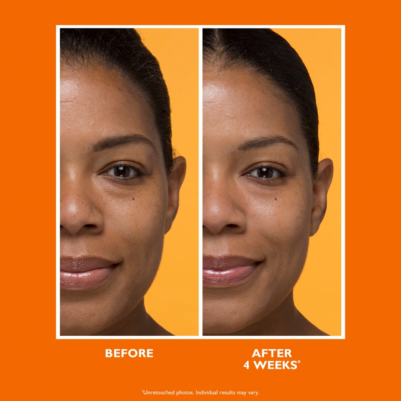 Peter Thomas Roth Potent-C™ Brightening Vitamin C Moisturizer 50 ml