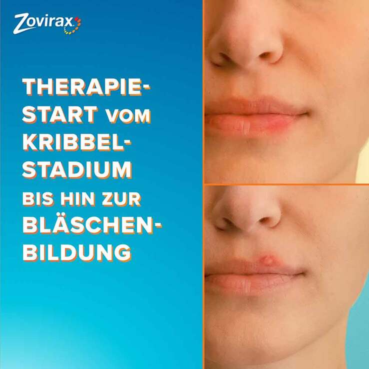 Zovirax Lippenherpescreme. 5 % Aciclovir, 2 g