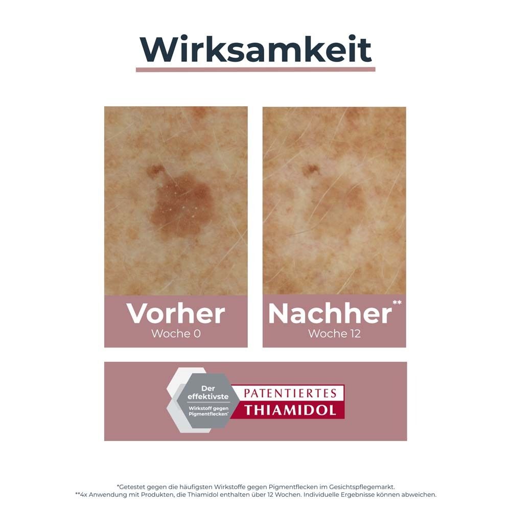 Eucerin® Anti-Pigment Korrekturstift – Gegen Pigmentflecken