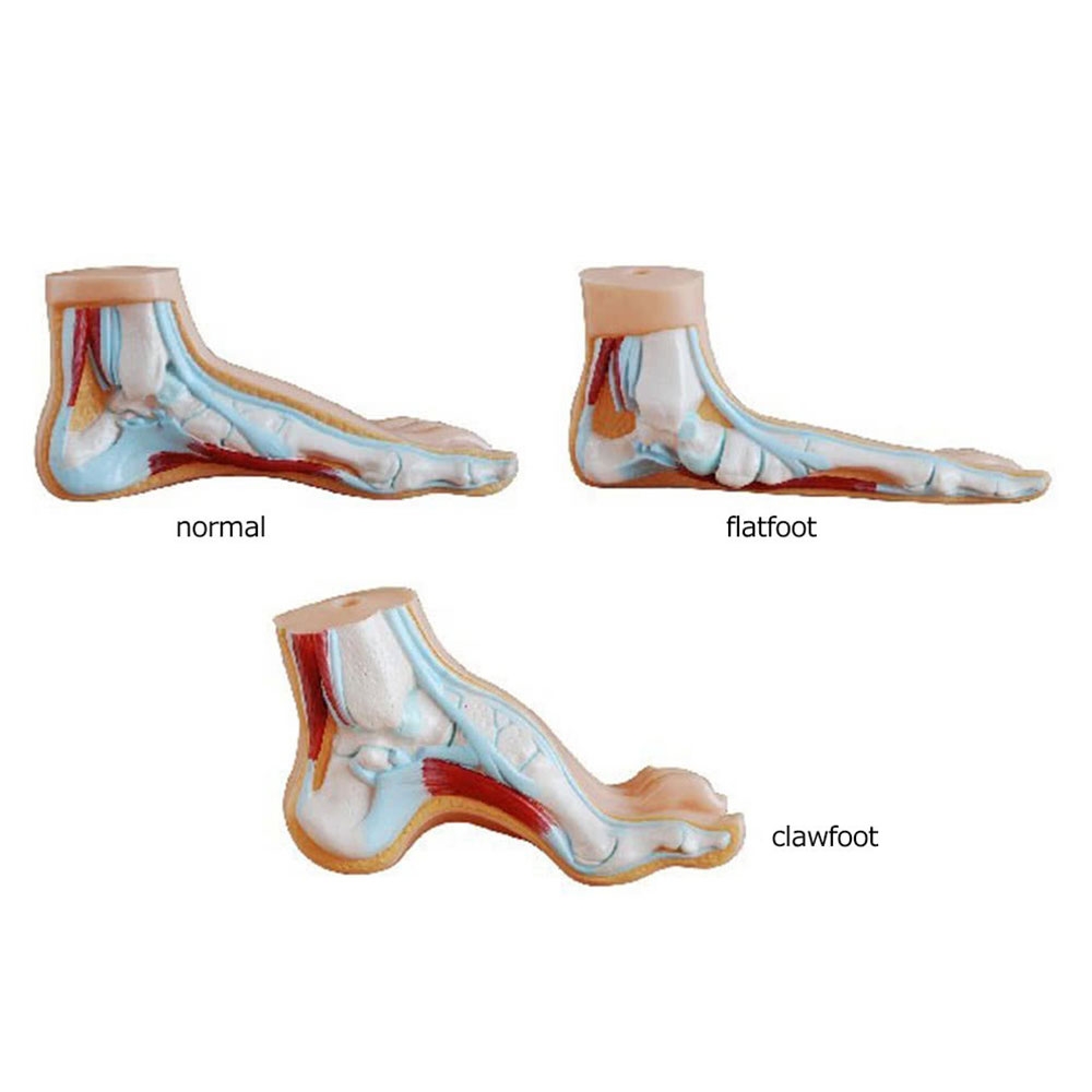 (1 Paar) Ultraweiche Silikon Gelpad Anti-Rutsch / Massage Einlagen für High Heels - Transparent