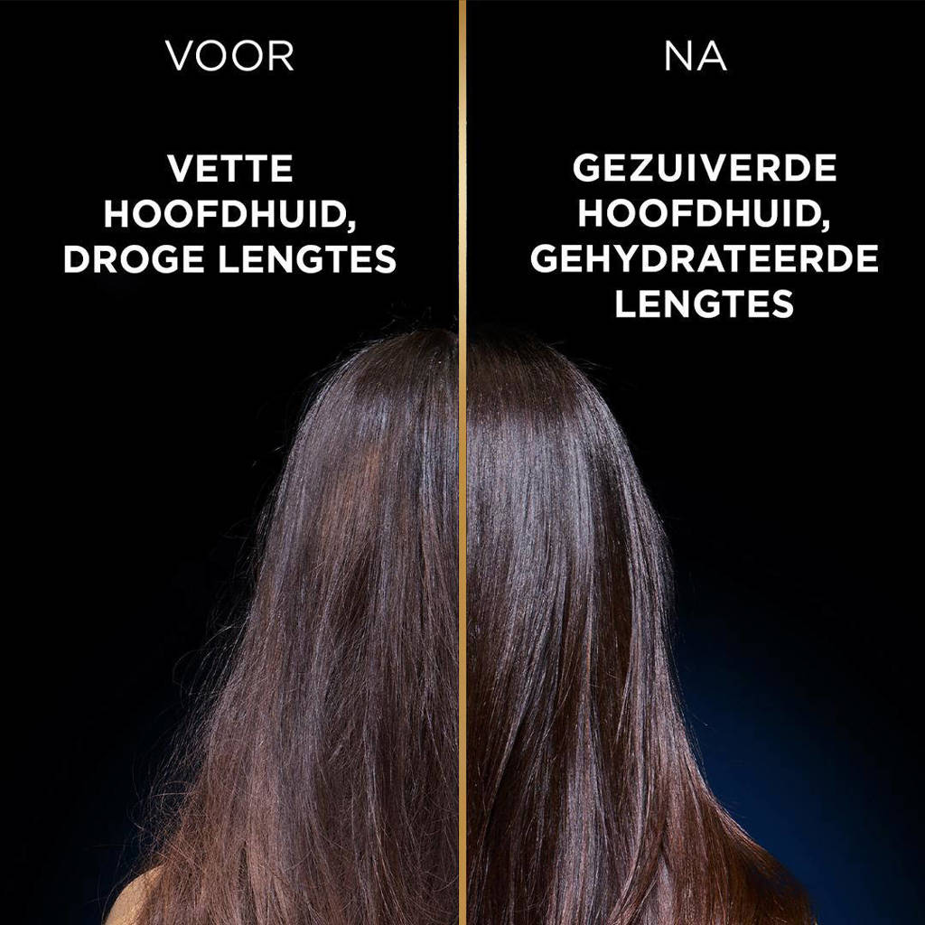 Magnetic Charcoal shampoo - 300 ml - 6 stuks - voordeelverpakking