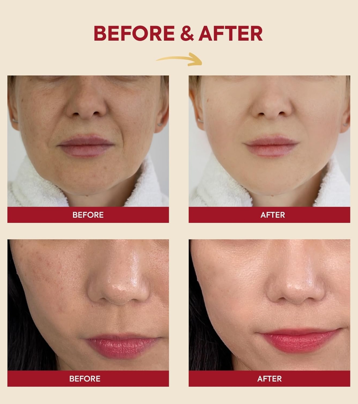 K-Secret - *Seoul 1988* - Essência Snail Mucin 97% + Rice