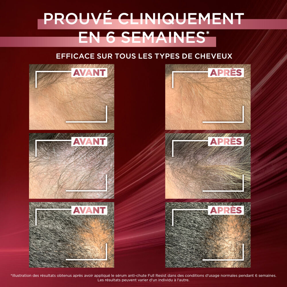 Elseve Full Resist Sérum Anti-Chute · Sérum Anti-Chute de cheveux