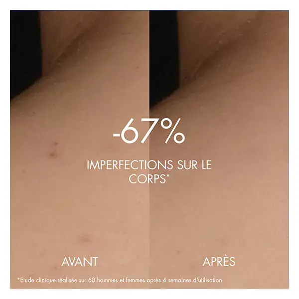 Sérum Corporal Anti-Imperfeições Biotherm Biocorps 200ml