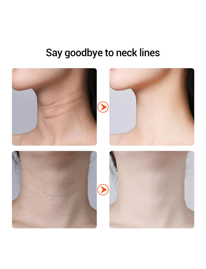 Facial Lifting Device