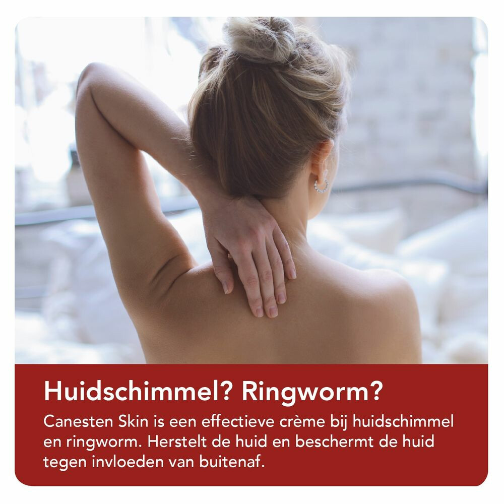Canesten Skin Crème bij Huidschimmel30 gr