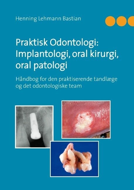 Praktisk Odontologi: Implantologi, Oral Kirurgi, Oral Patologi - Henning Lehmann Bastian - Bog