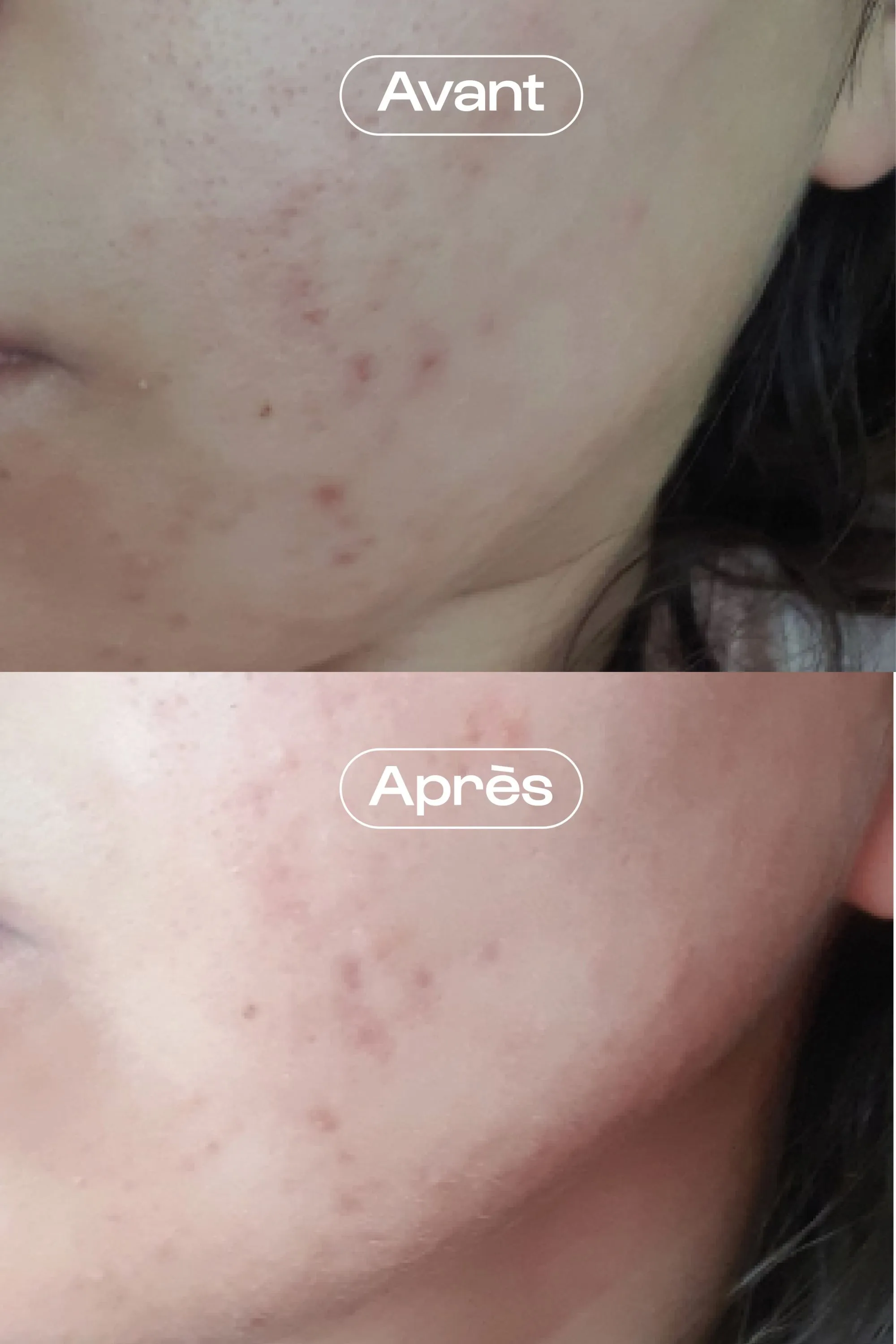 Omum Crème visage rééquilibrante et hydratante Ma Jolie Peau-40 ml