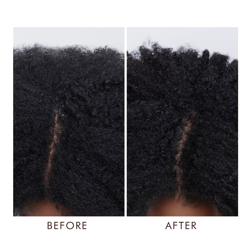 Moroccanoil Dry Scalp Treatment 45 ml