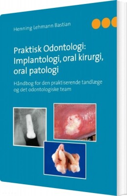 Praktisk Odontologi: Implantologi, Oral Kirurgi, Oral Patologi - Henning Lehmann Bastian - Bog